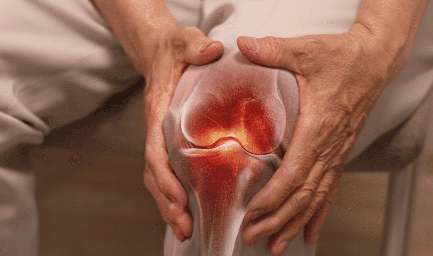 ACME Osteoarthritis