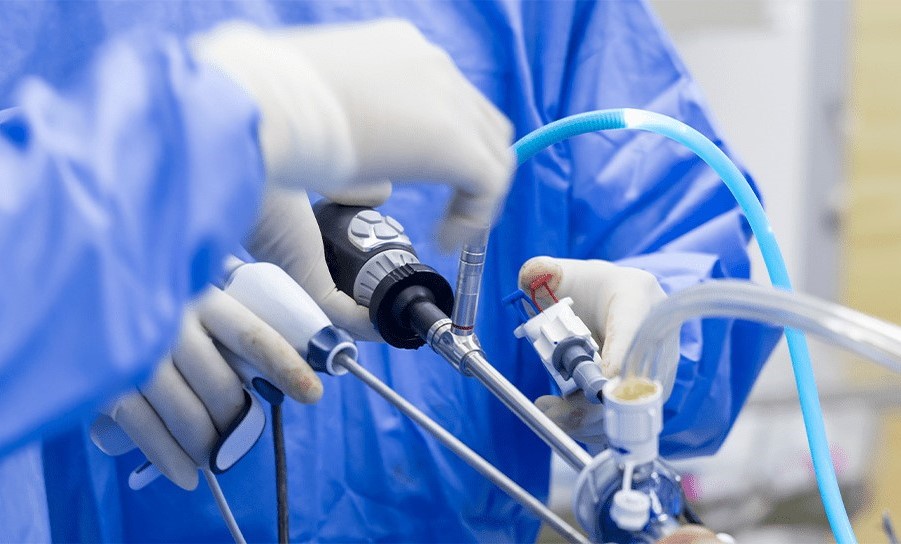 Arthroplasty