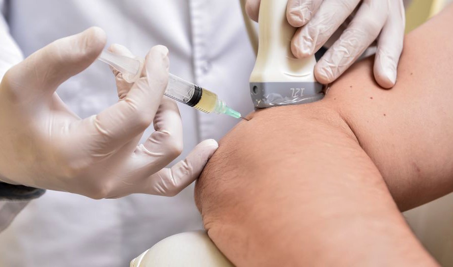 Cortisone