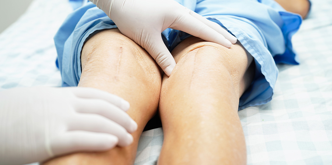 Complex Knee Deformities and Ligamentous Injuries