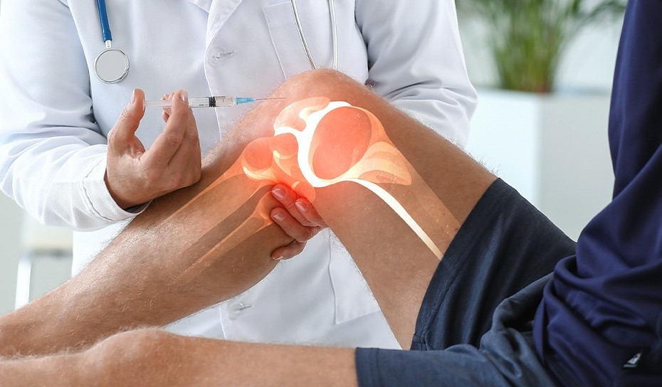 Intra articular
