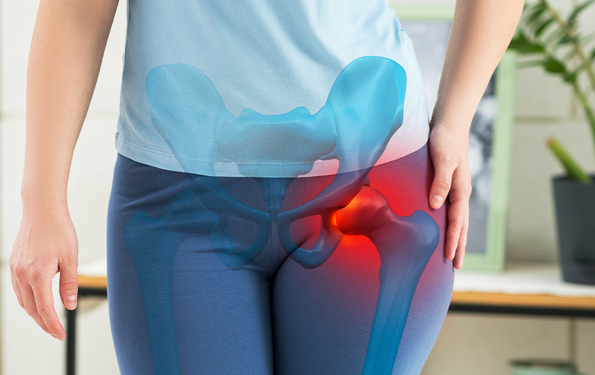 Trochanteric Bursitis w alpha