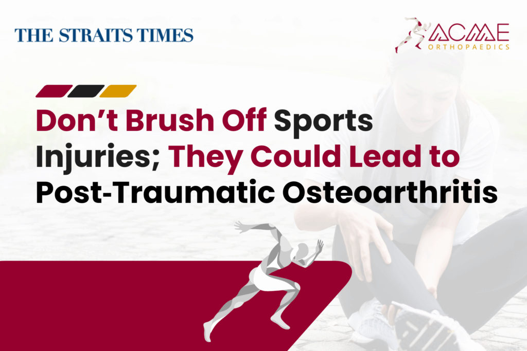 Don’t brush off sports injuries, they could lead to post-traumatic osteoarthritis